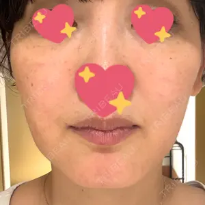 グナル美容外科梅田院口コミ