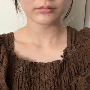 NARU Beauty Clinic 【ナルクリ】口コミ