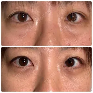 神戸美容外科 ネビュラクリニック口コミ