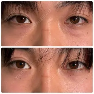 神戸美容外科 ネビュラクリニック口コミ
