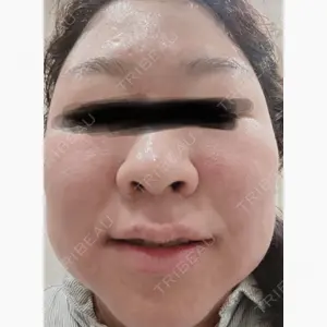 小倉美容外科/美容皮膚科 ビラビューティークリニック口コミ
