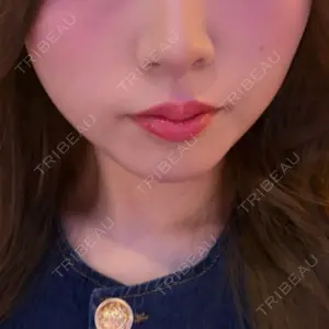 おおかみ美容のクリニック 新宿院口コミ