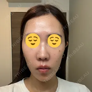 BiBiクリニック口コミ