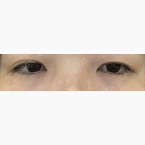 オアシス美容外科口コミ