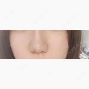東京形成美容外科 船橋院口コミ