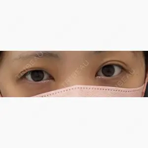 NARU Beauty Clinic 【ナルクリ】口コミ