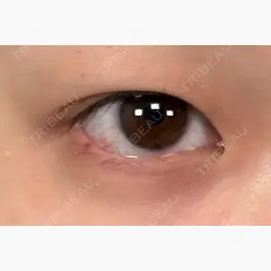 アリエル美容クリニック 大宮院口コミ