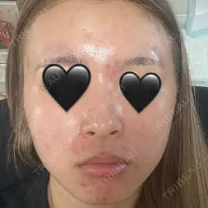 L‘amour clinic Tokyo【ラムールクリニック東京】口コミ