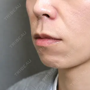 アリエル美容クリニック 大宮院口コミ
