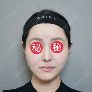 アリエル美容クリニック 大宮院口コミ