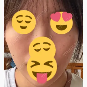 アメリクリニック福岡口コミ