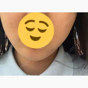 HAAB CLINIC 福岡院口コミ