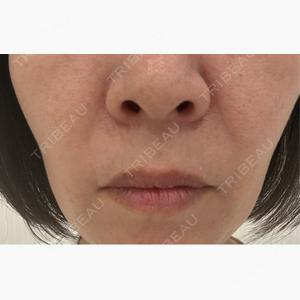NARU Beauty Clinic 【ナルクリ】 水戸院口コミ