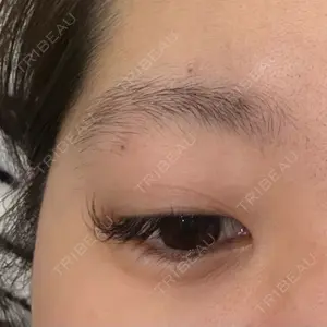 BiBiクリニック口コミ