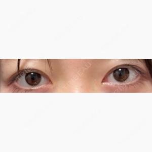 HAAB×DREAM BEAUTY CLINIC 大阪梅田院口コミ