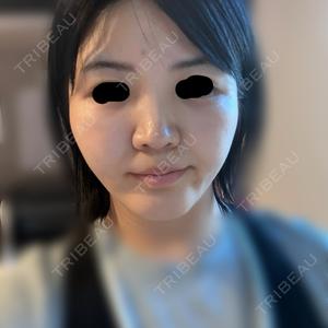 EMMA CLINIC（エマクリニック）口コミ
