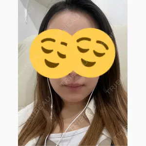 momo beauty  clinic口コミ