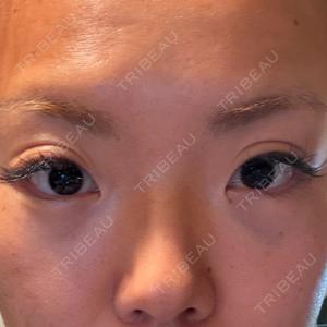 TCB東京中央美容外科 藤沢院口コミ