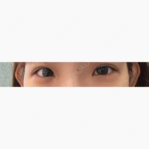 HAAB CLINIC 池袋院口コミ