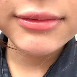 ルラ美容クリニック 渋谷本院口コミ