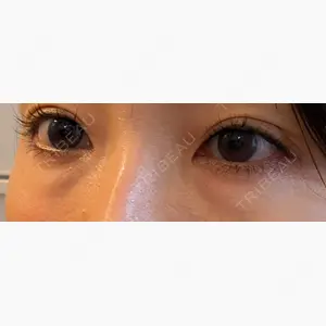 聖心美容クリニック 銀座院口コミ