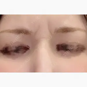 PRO CLINIC プロクリニック 銀座院口コミ