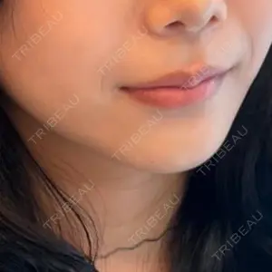 MIO CLINIC 梅田院口コミ