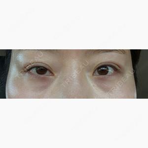 EMMA CLINIC（エマクリニック）口コミ