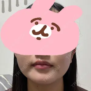東京ココセランクリニック口コミ