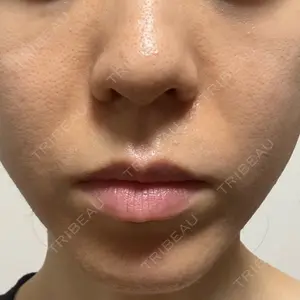 ルラ美容クリニック 静岡院口コミ
