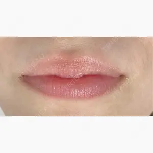 名古屋駅前ゆう美容クリニック口コミ