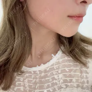 アメリクリニック福岡口コミ
