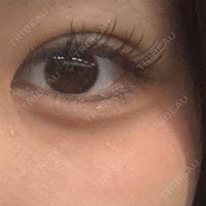 湘南美容クリニック 千葉センシティ院口コミ