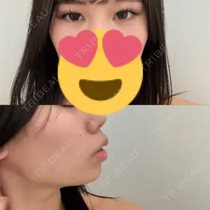 PRO CLINIC プロクリニック 銀座院口コミ