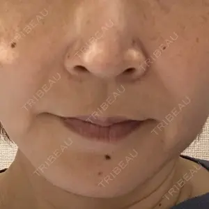 聖心美容クリニック 横浜院口コミ