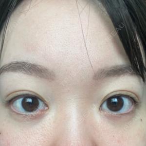 HAAB×DREAM BEAUTY CLINIC 東京本院口コミ