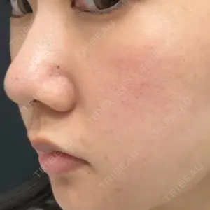 アリエル美容クリニック 水戸院口コミ