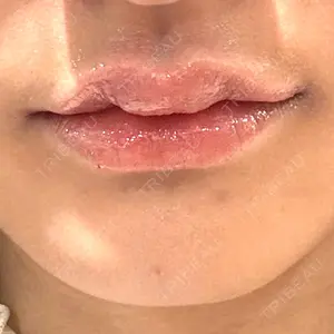 ルラ美容クリニック 広島院口コミ