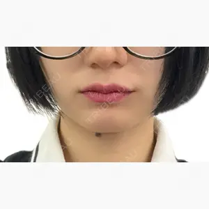 ルラ美容クリニック 大阪心斎橋院口コミ
