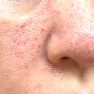ゆきスキンクリニック 東池袋口コミ