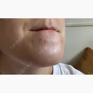 ルラ美容クリニック 京都院口コミ