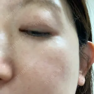 HAAB×DREAM BEAUTY CLINIC 大阪梅田院口コミ