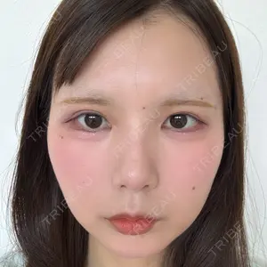 R Beauty CLINIC 大阪院口コミ