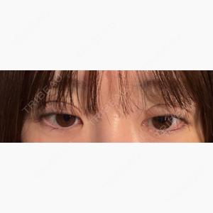 アリエル美容クリニック 水戸院口コミ