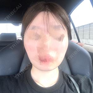 アデル美容クリニック口コミ