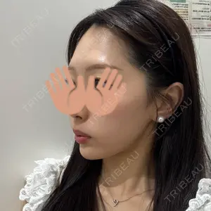 HAAB×DREAM BEAUTY CLINIC 大阪梅田院口コミ