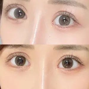 HAAB×DREAM BEAUTY CLINIC 東京本院口コミ