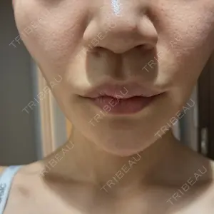 DAILY SKIN CLINIC 新宿院口コミ