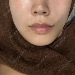 おおかみ美容のクリニック 横浜院口コミ