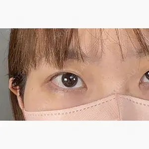 アリエル美容クリニック 大宮院口コミ